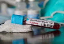 Il tampone di verifica sui positivi ha dato esito negativo. D’Acampora: «Sequestrati in casa» Covid-19 bellizzi