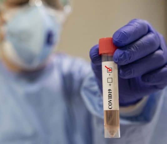 Eboli: boom di contagi in un’azienda agricola. 24 positivi Covid-19 Eboli