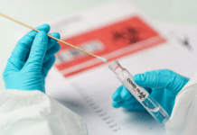 Covid-19: quattro nuovi casi positivi a Battipaglia Covid-19